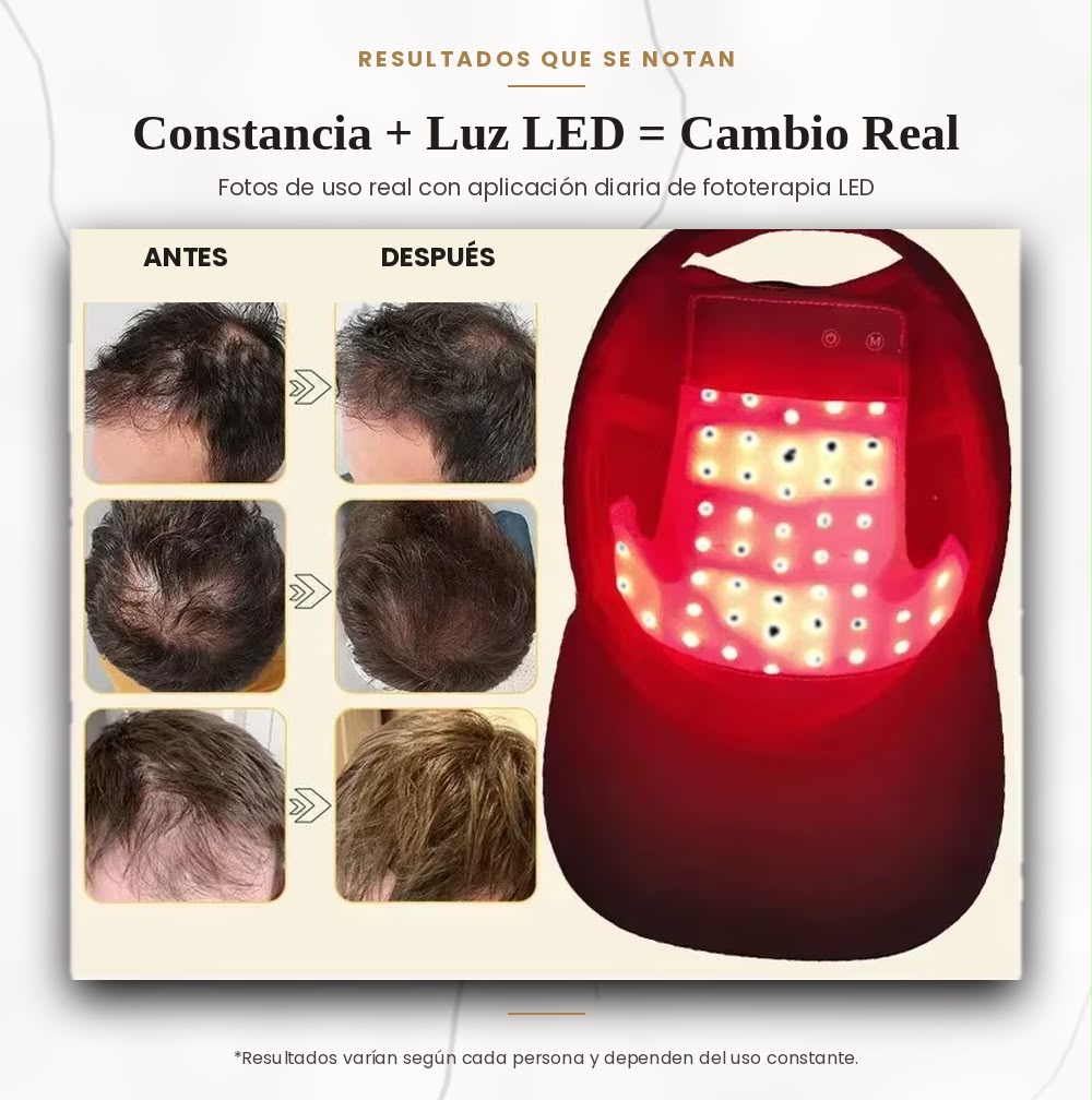 LumiCap Pro — Casco LED de Fototerapia Capilar