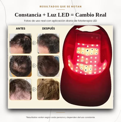 LumiCap Pro — Casco LED de Fototerapia Capilar