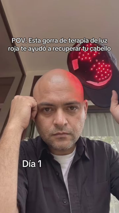 LumiCap Pro — Casco LED de Fototerapia Capilar
